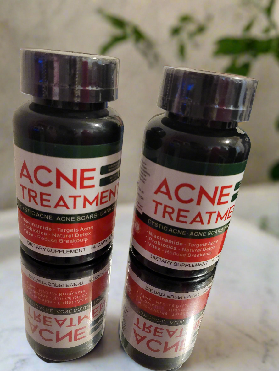 Acne treatment supplement/ Cystic acne/ dark spots / break out