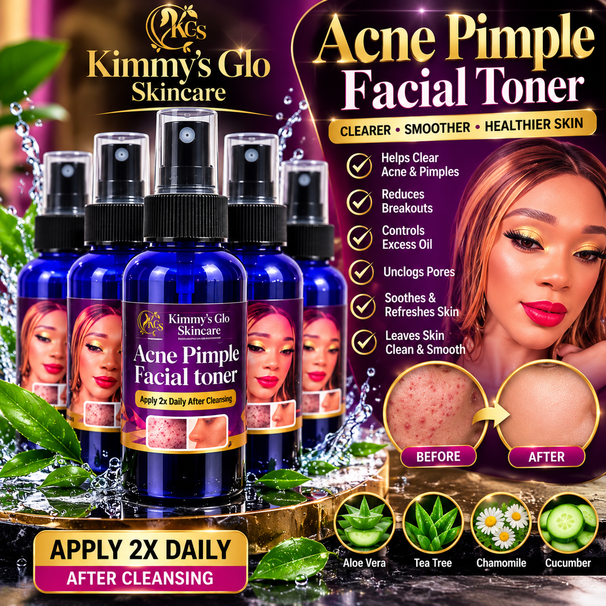 Acne pimple toner